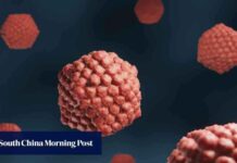 发现拯救大脑免受疱疹侵害的基因:中国研究人员的贡献 news-29072024-151344