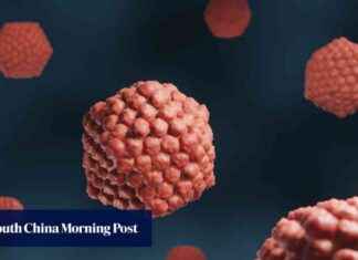 发现拯救大脑免受疱疹侵害的基因:中国研究人员的贡献 news-29072024-151344