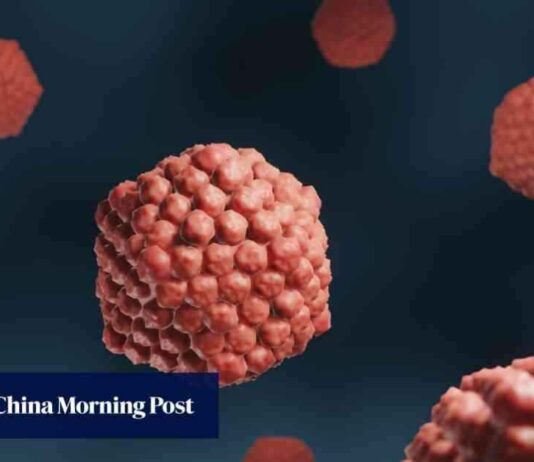 发现拯救大脑免受疱疹侵害的基因:中国研究人员的贡献 news-29072024-151344