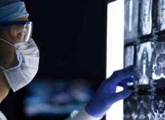 癌症診斷增加,但存活率也提高 news-18092024-104902