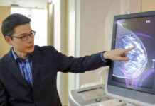 3D乳腺X光对密集乳房的优势 news-26092024-205321