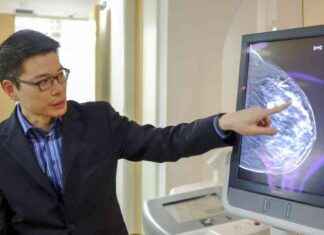 3D乳腺X光对密集乳房的优势 news-26092024-205321